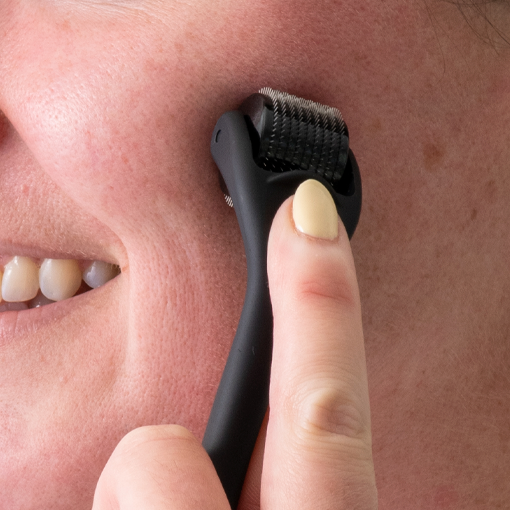 Smiling woman applying a derma roller to her face for skin rejuvenation, collagen production, and improved absorption of skincare products. Explore the benefits of at-home microneedling with DermTechRoller.